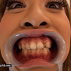 【マニアック歯フェチ動画】黒ギャル痴女に開口器をつけてもらい、歯みがきしました