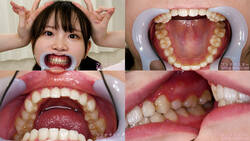 【치아 페티쉬】후지타 코즈에의 이빨을 관찰했습니다!