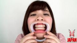 A must-see for tooth fetishists!  My teeth are a mess!  Hikaru AKANE 