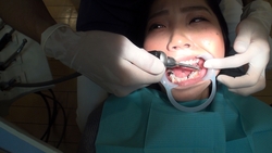 素人まことさんのリアル歯科治療映像（４回目）