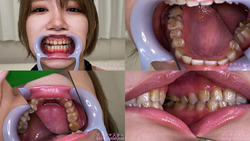 [Tooth fetish] I observed Yumeru Kotoishi&#39;s teeth!