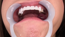 Ai Takano's Dental **** : A POV Drooling Puddle of Teeth and Candy Crush!