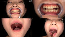 「[牙齒/口腔]超級受虐狂女孩的口腔、牙齒、喉嚨內部的超罕見觀察★」 日野伊織