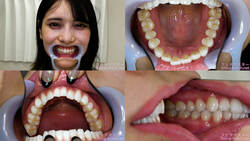 【치아 페티쉬】미이 미카나의 이빨을 관찰했습니다!