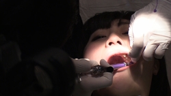 御坂美琴（２１）のリアル歯科治療映像　（２回目）