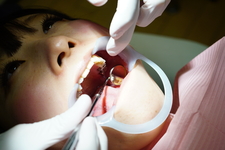 Dental Treatment ; Amateur Girl AOI (2nd Time)