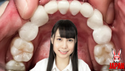 Take a look at Yuria TSUKINO teeth with lots of ceramic!